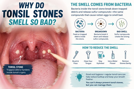 Why Do Tonsil Stones Smell So Bad?