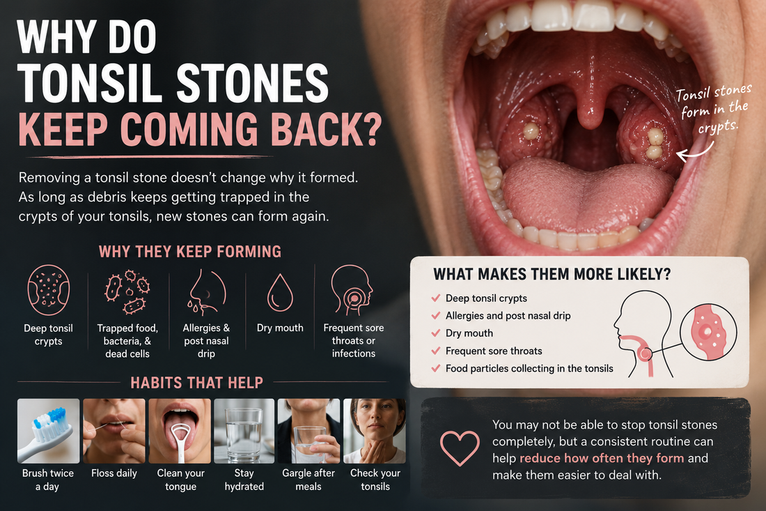 Why Do Tonsil Stones Keep Coming Back?