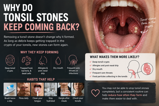 Why Do Tonsil Stones Keep Coming Back?