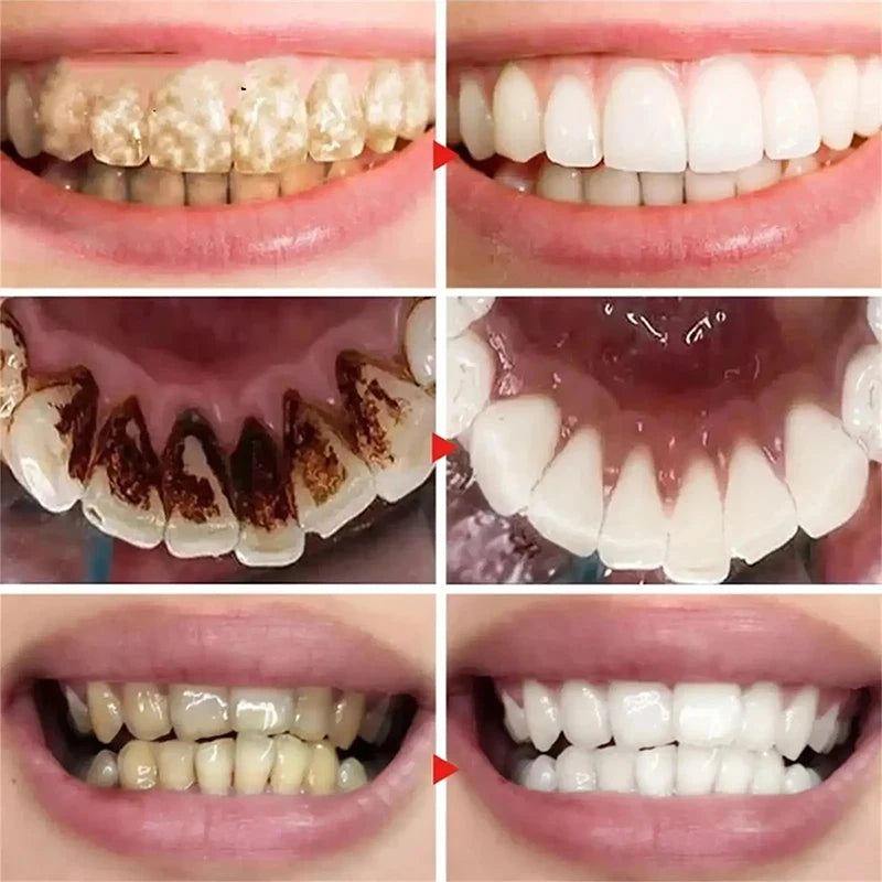 5D Teeth Whitening Toothpaste Stick – Fresh Breath & Oral Care