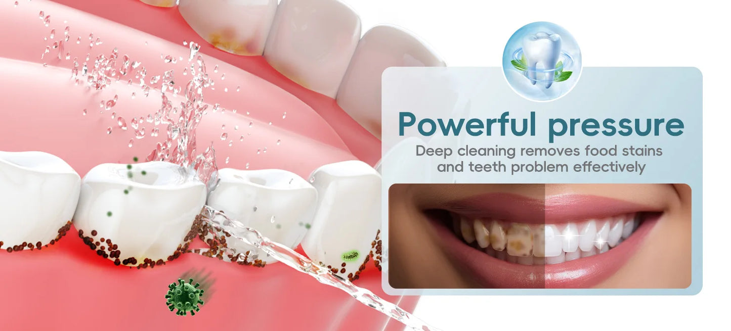 Cordless Water Dental Flosser – 300ML Portable Oral Irrigator