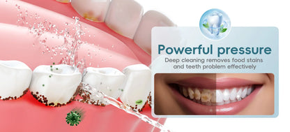 Cordless Water Dental Flosser – 300ML Portable Oral Irrigator
