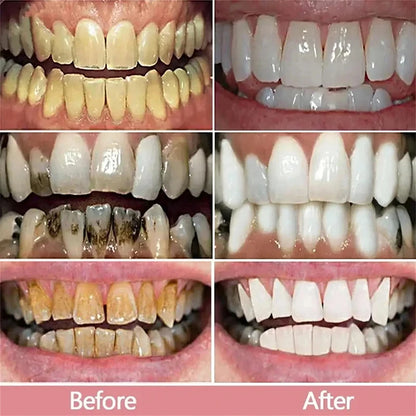 5D Teeth Whitening Toothpaste Stick – Fresh Breath & Oral Care