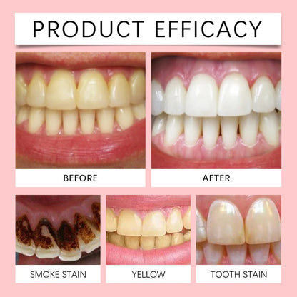 SP6 Probiotic Toothpaste – Deep Cleaning & Gum Protection (120g)