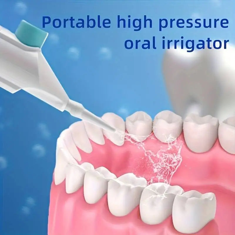 Household High-Pressure Oral Irrigator – Portable Teeth Cleaning Tool