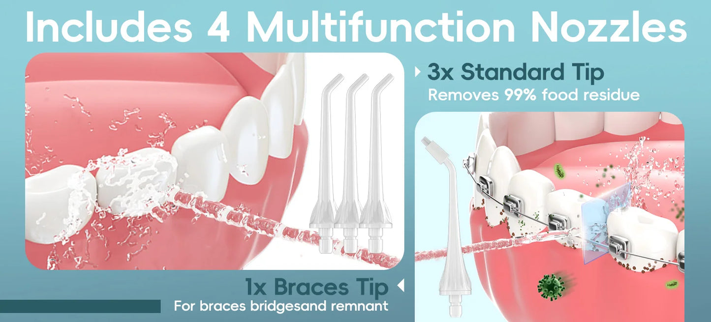 Cordless Water Dental Flosser – 300ML Portable Oral Irrigator