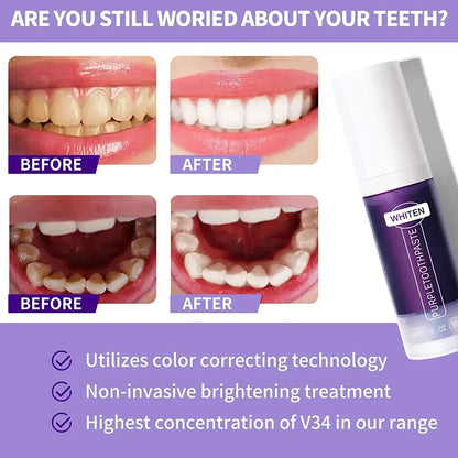5D Teeth Whitening Toothpaste Stick – Fresh Breath & Oral Care