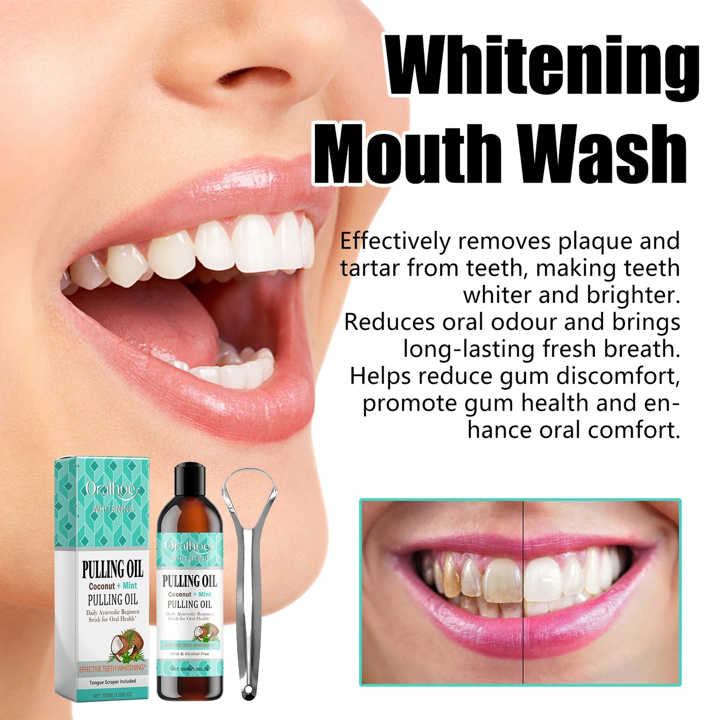 Gum Repair Drops – Relief for Swollen & Receding Gums