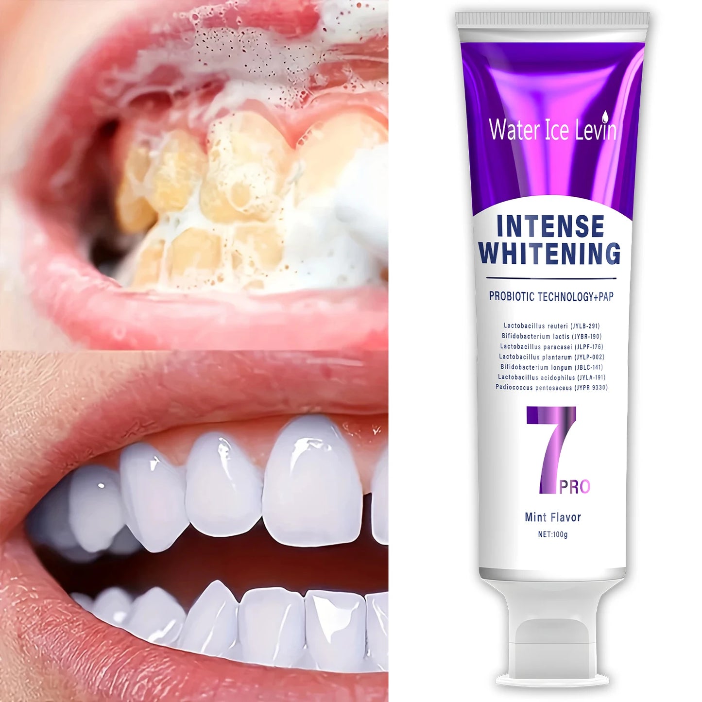 Probiotic Whitening Toothpaste – Family Oral Care & Fresh Breath
