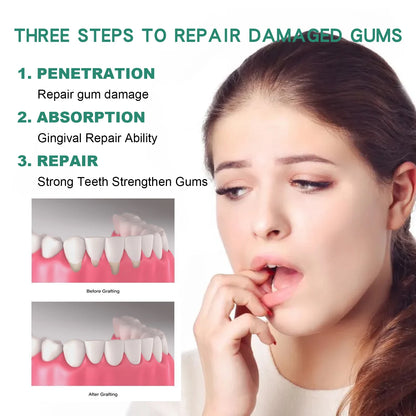 Gum Repair Drops – Relief for Swollen & Receding Gums