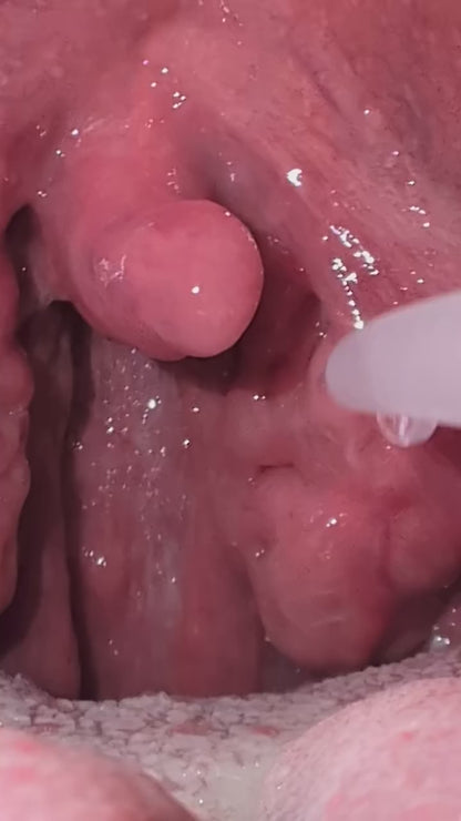 Complete Tonsil Stone Care Kit