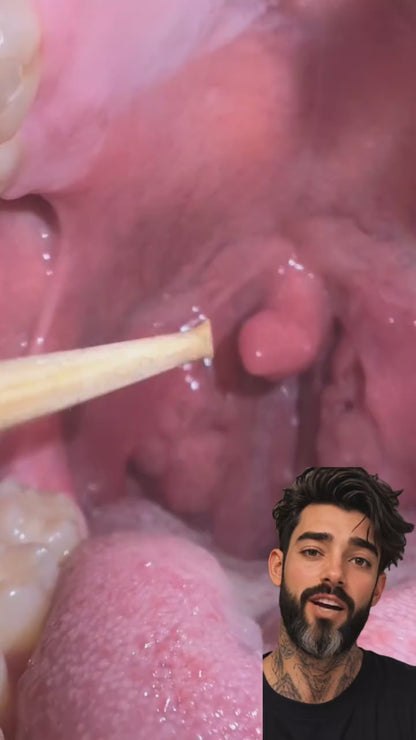 Complete Tonsil Stone Care Kit